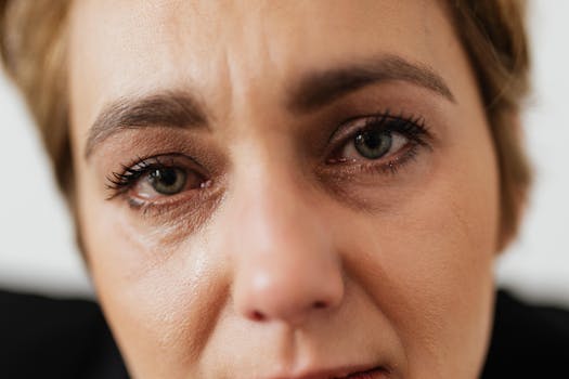 Eye Cleaning and Tear Stain Removal for Dogs