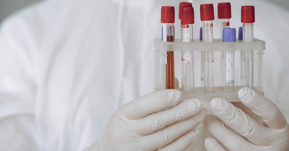 Cat Blood Tests Explained: Understanding Your Cat's Lab Work
