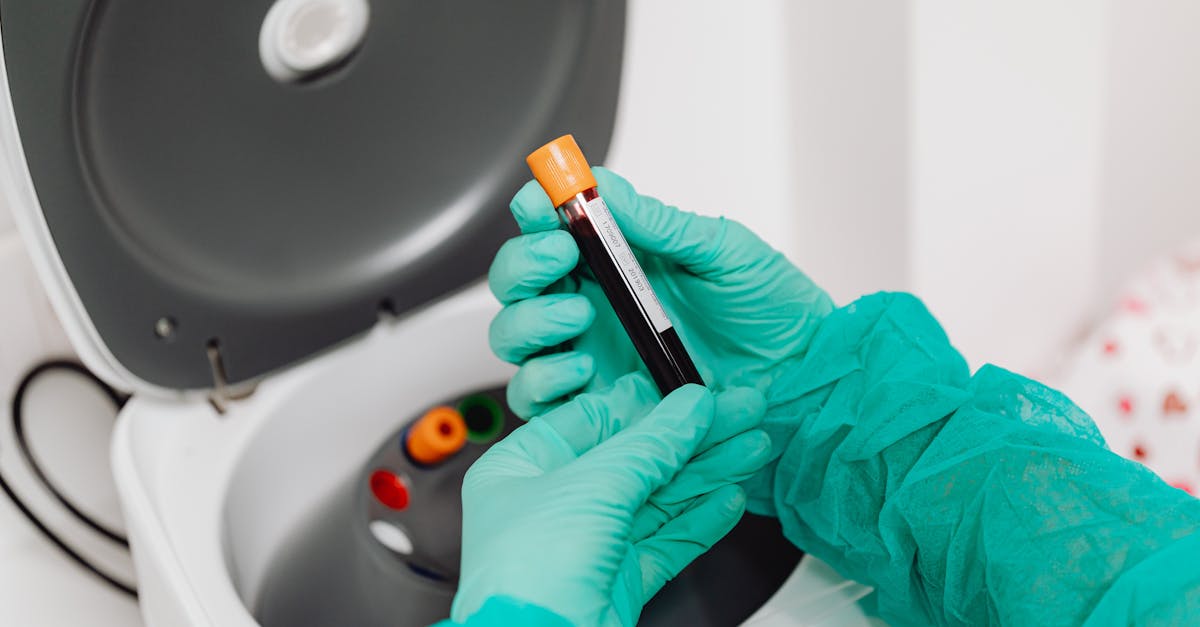 Understanding Your Dog's Blood Work: What the Numbers Mean